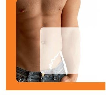 Indicação Strataderm em qualquer área do corpo