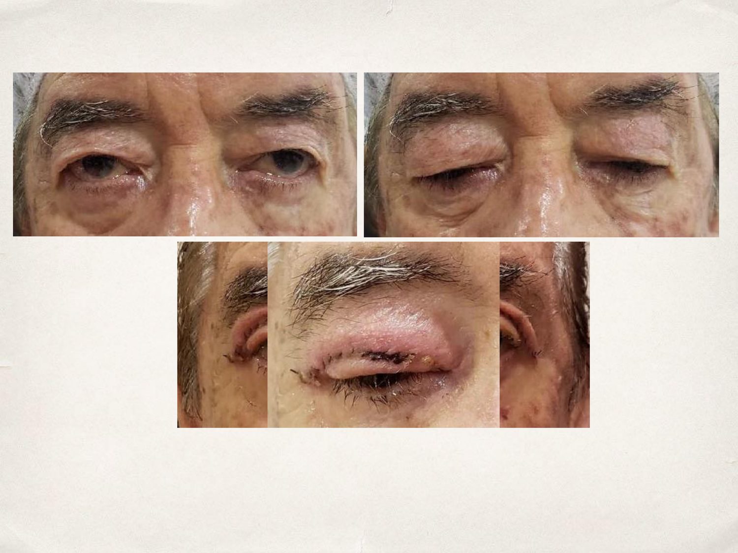 Painel de evolução de caso do protocolo Stratamed em oculoplástica. (Imagem repr